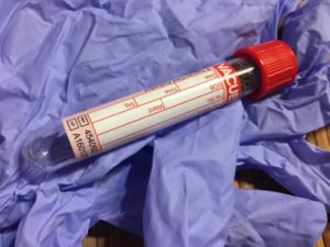 blood test, test tube