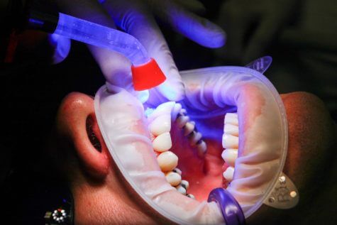 Person undergoing treatment at dentist