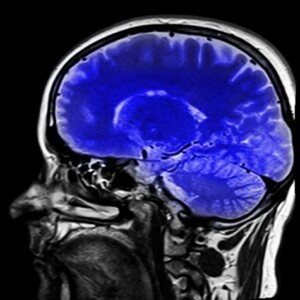 Humanlike cognition began nearly 1.8 million years ago, a new study finds.