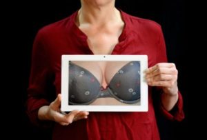 Breast implants