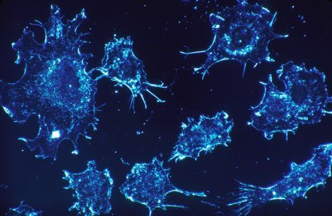 cancer-cells-541954_640