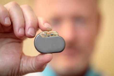 Vagus nerve stimulator