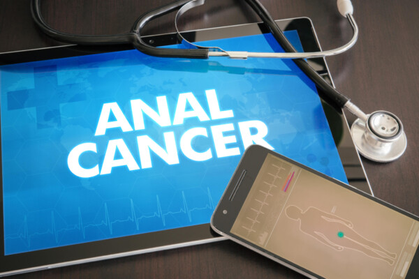 Anal cancer