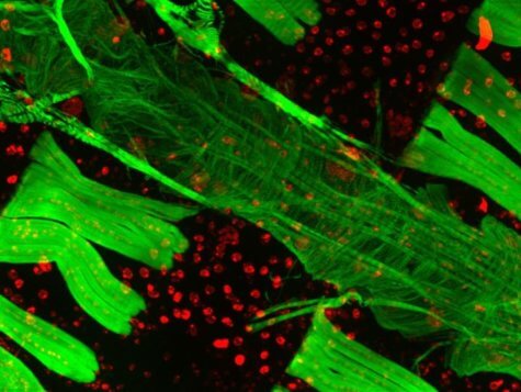 Fruit flies heart muscles