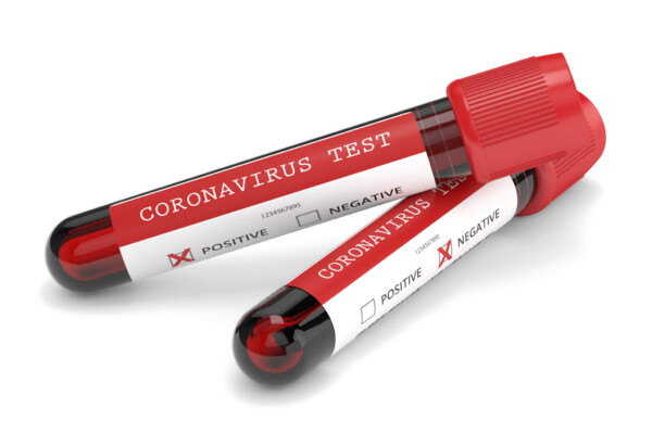Coronavirus test tubes