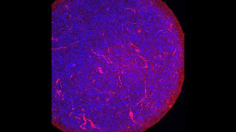 'Mini-brain' bioengineered from human stem cells