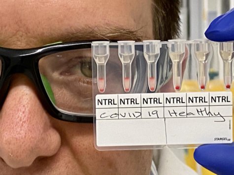 Coronavirus blood test