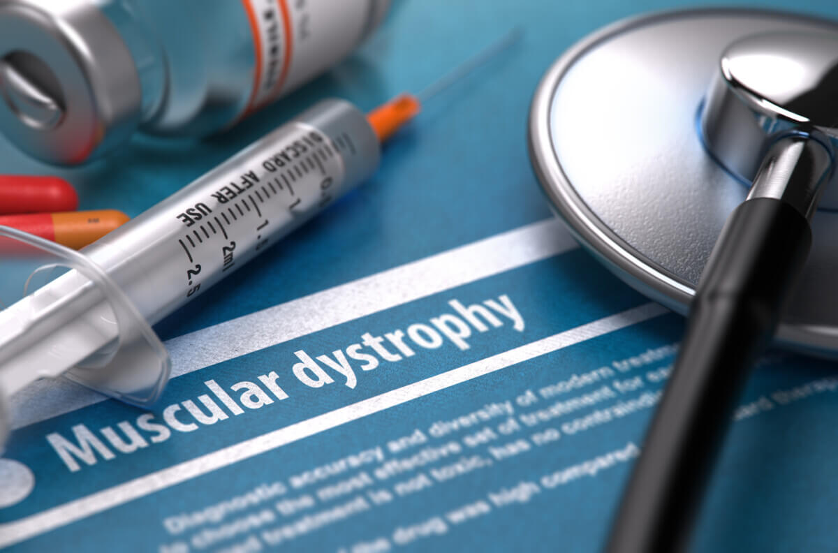 Muscular dystrophy. Medical Concept on Blue Background.