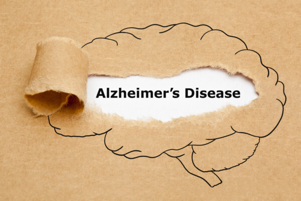 Alzheimer's Disease