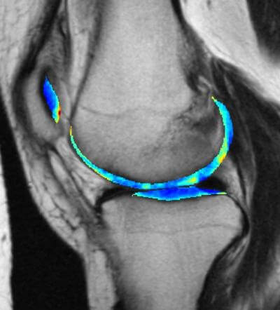 Knee scan