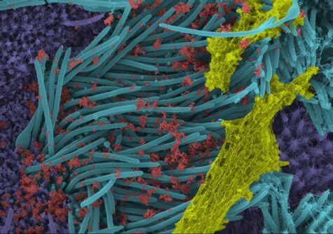 SARS-CoV-2 virions (red).