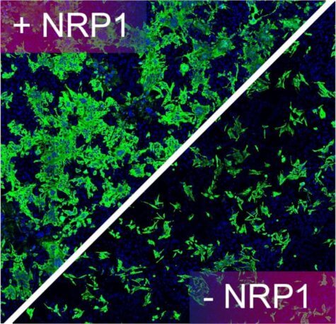 COVID-19 protein Neuropilin-1
