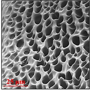 Hydrogel