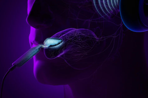 Tinnitus Tongue treatment