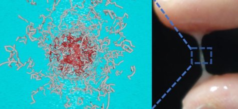dry mouth hydrogel