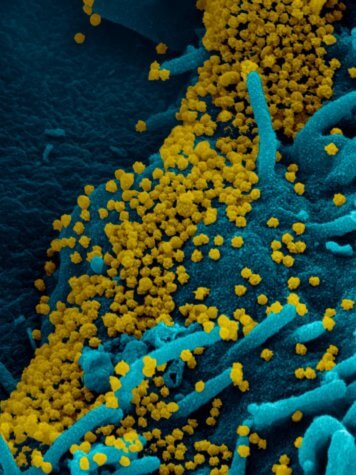 COVID Virus infection