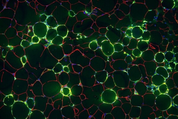 Fat cells, inflammation