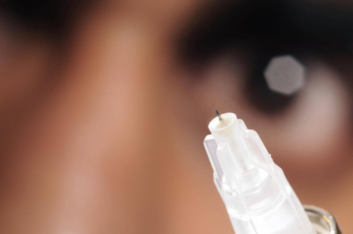 needle glaucoma treatment