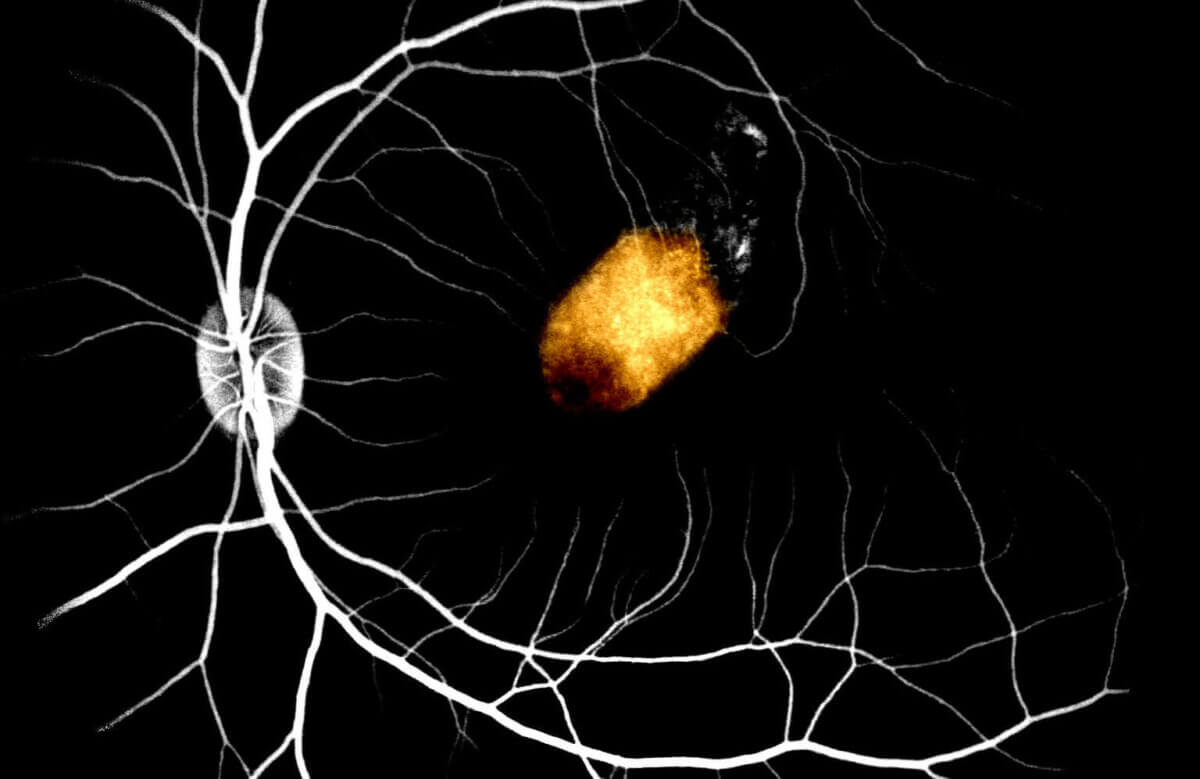 eye-see-dead-pe-620269