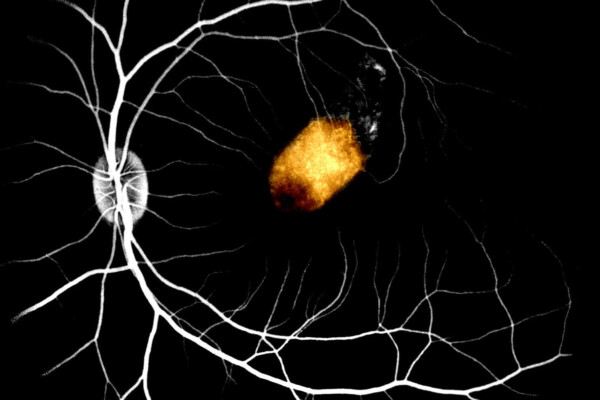 Stem cell corpse study