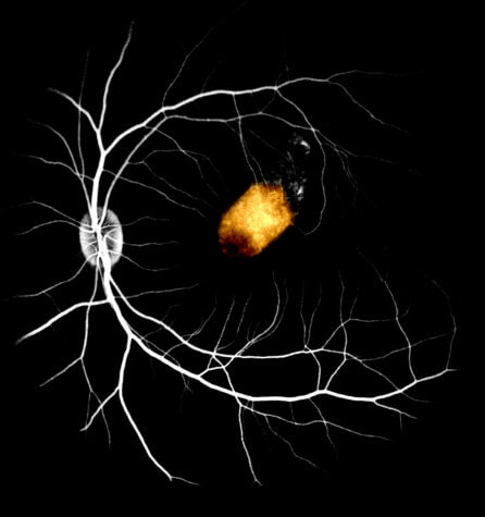 Stem cell corpse study