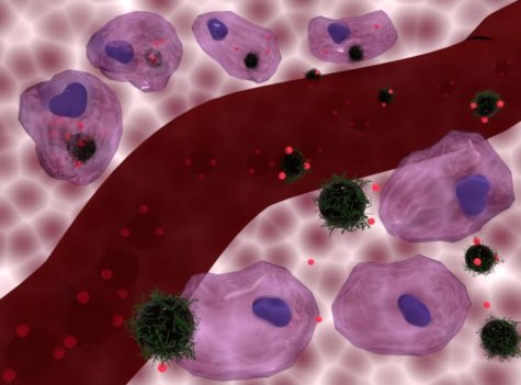 heat and chemotherapy cancer treatment