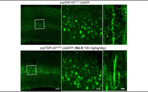 ALS compound brain cells