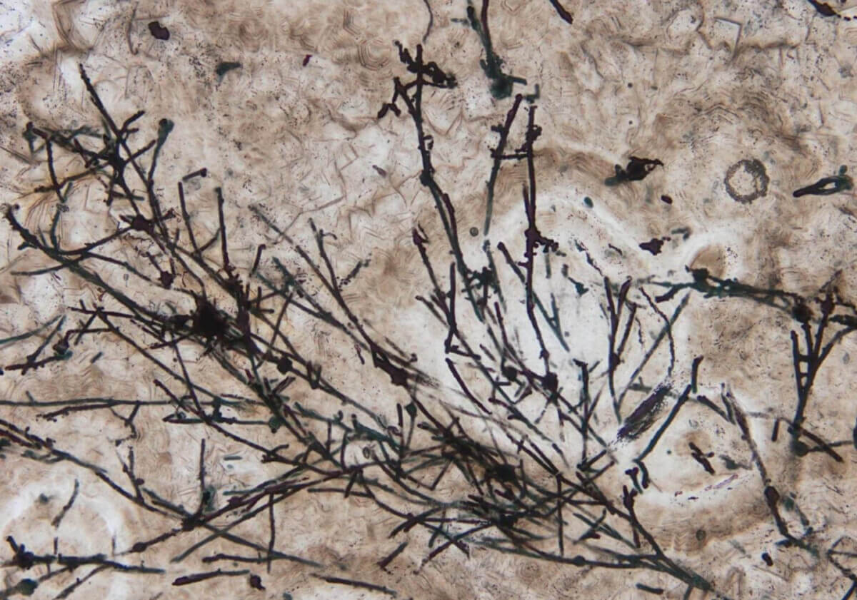 ancient-fungus–628403