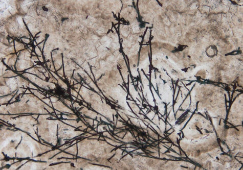 Ancient fungus fossil three times older than dinosaurs