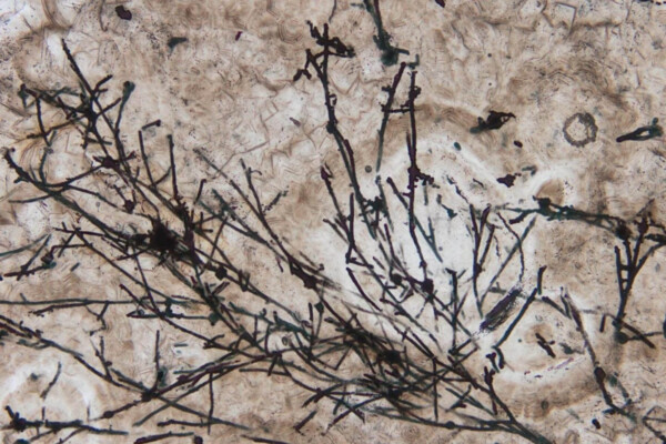 Ancient fungus fossil three times older than dinosaurs