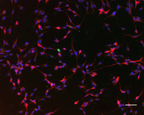 Hippocampal precursor cells