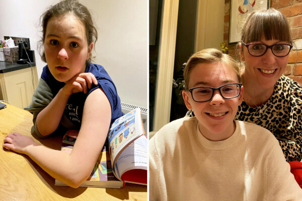 Children in Oxford/AstraZeneca COVID-19 vaccine trial