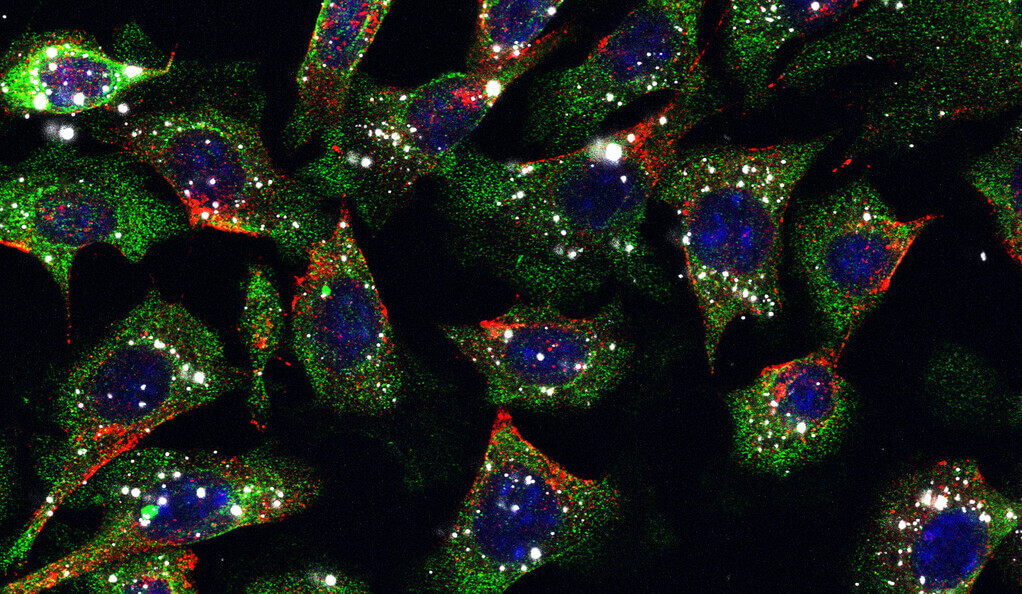 skin cancer nanoparticles