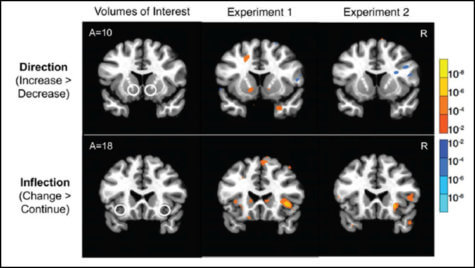 Brain scans could predict stocks study