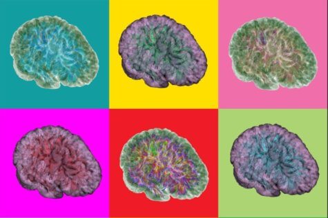 brain injury scans