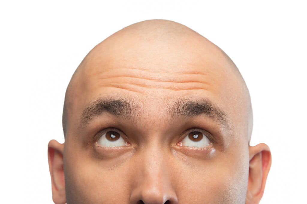 Bald man
