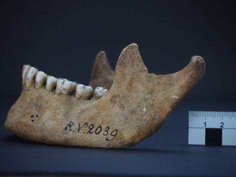 Black death plague found in skull