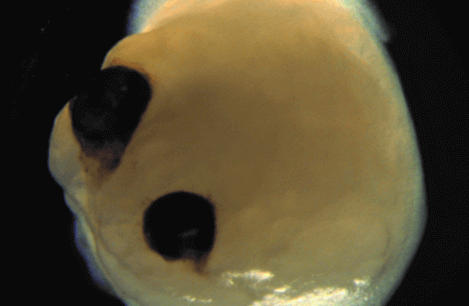 Lab-grown brain with eyes