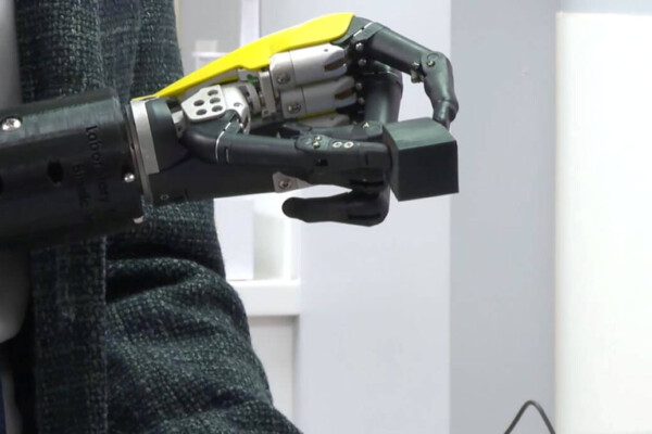 Bionic hand