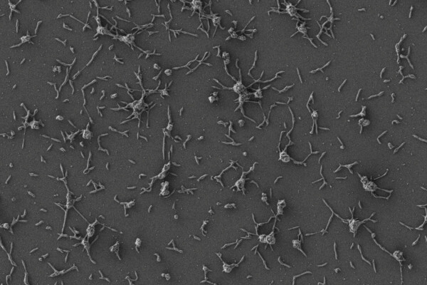 Mycoplasma pneumoniae cells