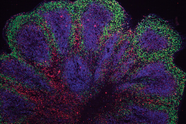 Mini-brain organoids