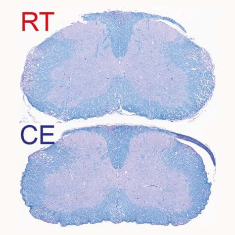 Demyelinated spinal cord of mice 