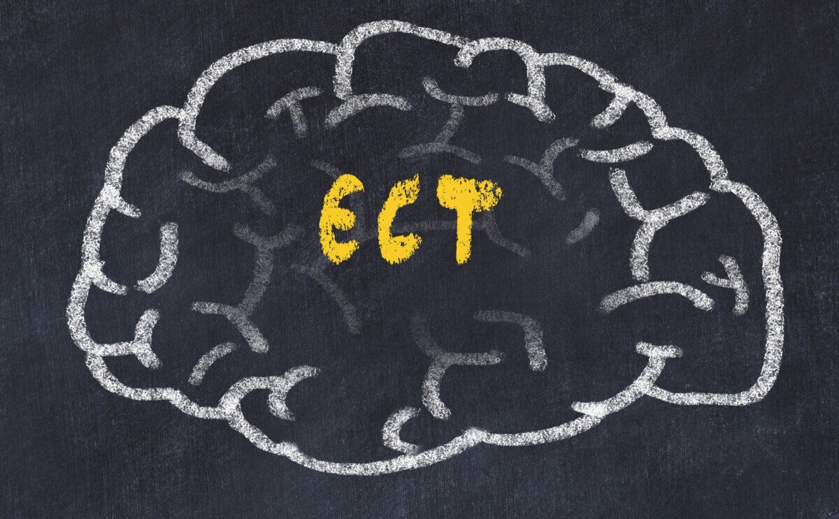 ECT on brain