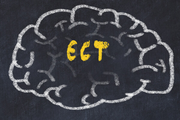 ECT (Electroconvulsive therapy)