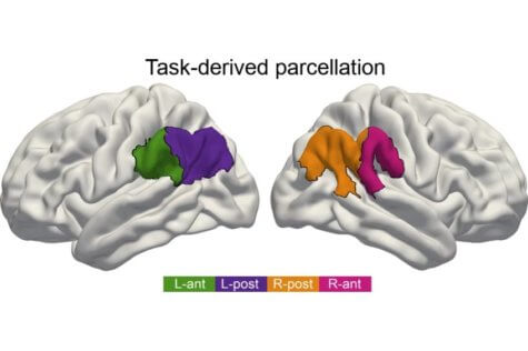 Brain IPL