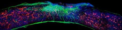 Spinal cord section