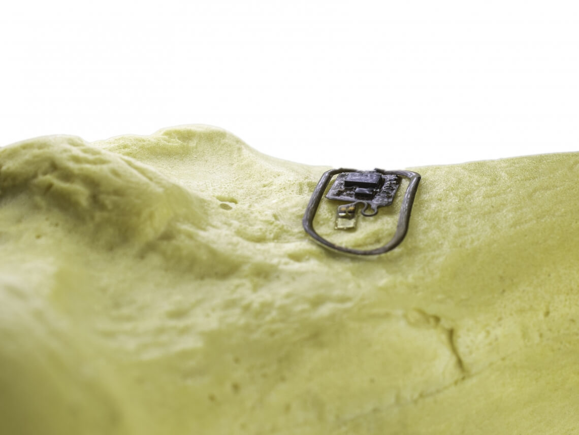 bone microchip