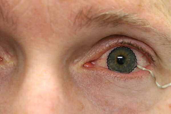 Contact lenses with biosensor