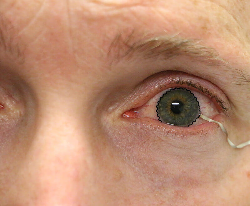 Smart contact lenses