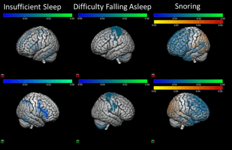 sleep brain